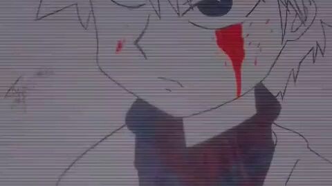 killua 💖