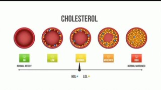 HIGH CHOLESTEROL SYMPTOMS