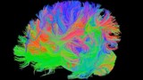 Human Brain Connectivity (DTI) - 20 year old female
