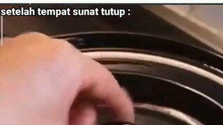 kalian yang abis sunat pernah berpikir gini?