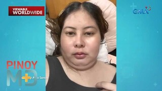 Iniinom na gamot para sa sakit ng ulo, sanhi raw ng biglang paglobo ng katawan?! | Pinoy MD