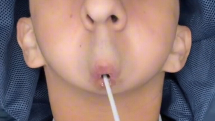 天生缺陷又如何，没有下巴甚至不会说话成为说唱歌手#励志 #奇闻趣事 #令人震惊 #说唱歌手