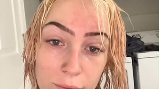 The young lady uses her own experience to warn everyone: There are risks in pursuing beauty, and you