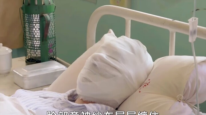 Scalding boiling water was poured on her husband, resulting in severe disfigurement #MyThreeMomsAndT