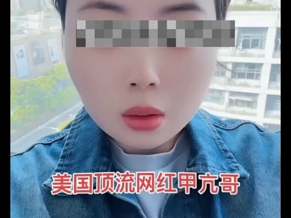 爱果tv之美国顶流网红甲亢哥