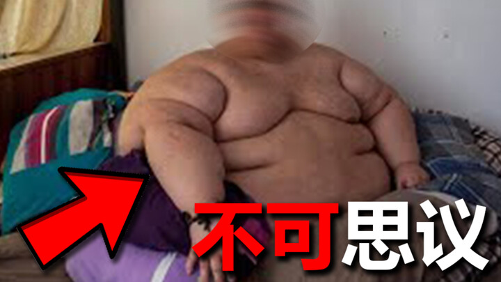 What’s it like when the king orders you to lose weight?