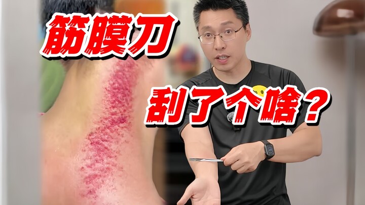 【Pisau Fasia】Prinsip Neurologis di Balik Pelepasan Benjolan dan Adhesi Otot | Berbagi Konten Bermanf