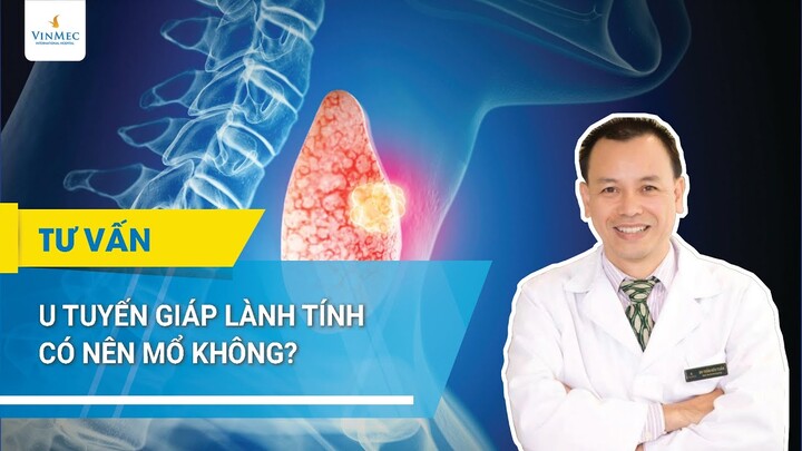 U tuyến giáp lành tính có nên mổ không?| BS Trần Hữu Tuấn, BV Vinmec Times City