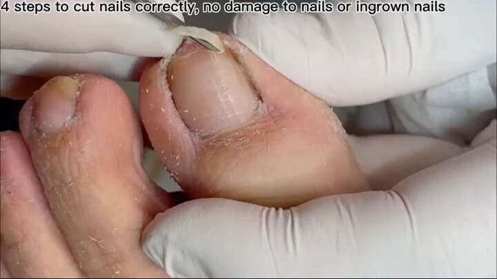 Never know so much dirt under toenail_R
