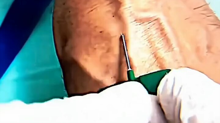 I’ve seen people afraid of shots, but I’ve never seen anyone this scared.