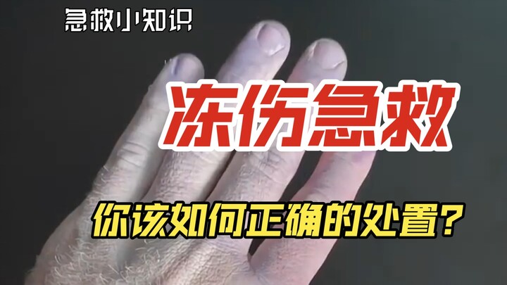 【Hardcore Skills】Do you know the quick and correct first-aid methods for frostbite?