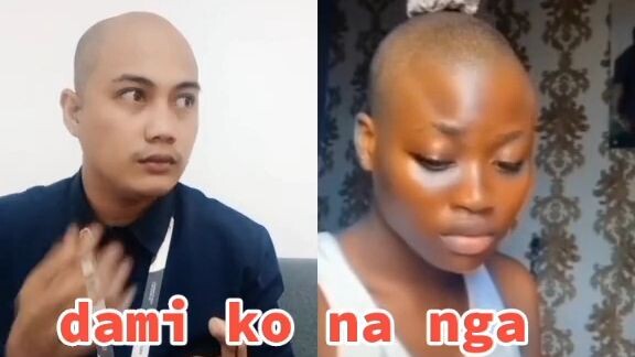 hair problem ba?😅😅😅