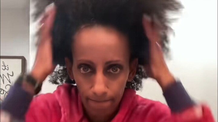 Ketika Kamu Tidak Punya Rambut Orang Asia