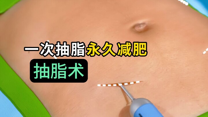 คนที่คิดค้นวิธีดูดไขมันช่างเป็นอัจฉริยะจริงๆ!