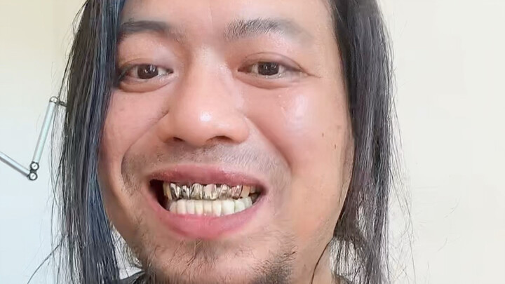 Got a big steel tooth
