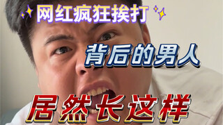 ชายที่ถือกล้องไว้บนหัวในที่สุดก็เผยใบหน้าของเขาออกมา!