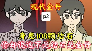 全球灵气复苏，你体内的108颗结石全变成了金丹! p2