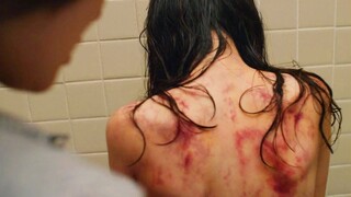 When She Finds Out About These Marks, She Does This...