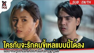 ใครกันจะรักคนขี้เหล่แบบนี้ได้ลง