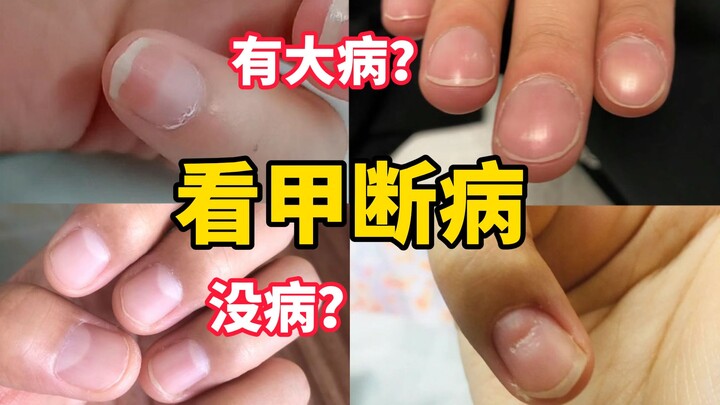 Tự kiểm tra ngay! Những triệu chứng này chính là “tín hiệu bệnh”