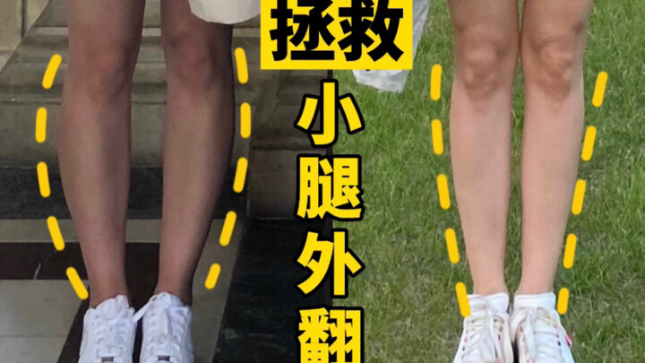 هذه 6 حركات مجربة وفعّالة! هناك أمل لتصحيح تقوس الساقين للخارج! تمارين لا غنى عنها لتصحيح تقوس الساق