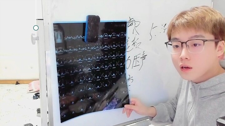 【0103】Chen Ze keluarkan hasil CT, para penggemar serentak jadi dokter (versi lengkap)