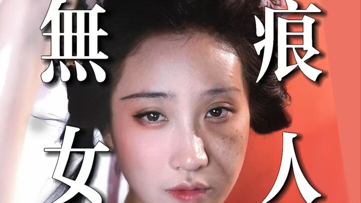 What really needs to be covered up isn’t the scars, but the prejudice.