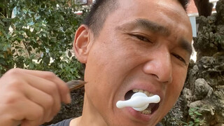 #How harmful is long-term chewing of betel nut? #Oral submucous fibrosis daily mouth opening trainin