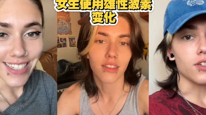 女生使用雄性激素半年后的变化