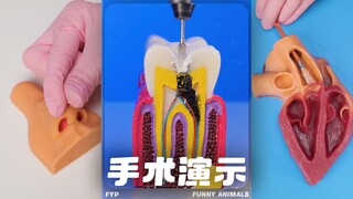⚠️一些手术的简单演示⚠️