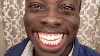 Saat suasana hati sedang buruk, lihat saja gigi putih besar ini.