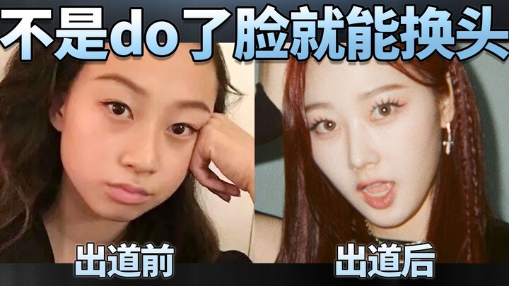 Your natural facial structure determines the upper limit of your looks.