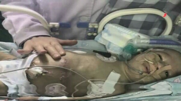 Tears! When she was about to remove the baby's oxygen supply and had no other help, the child sudden
