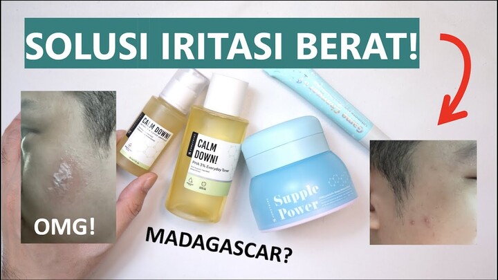 REVIEW SOMETHINC CALM DOWN TONER & AMPOULE | SUPPLE POWER BOMB | GAME CHANGER ULTIMATE EYE GEL!