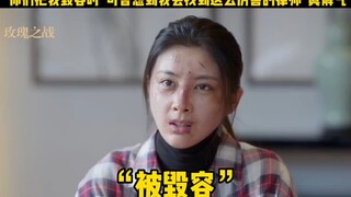 女孩浑身被毁容却只赔15万女孩找来了律师，厂家慌了