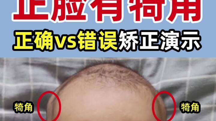 Gương mặt chính diện có sừng