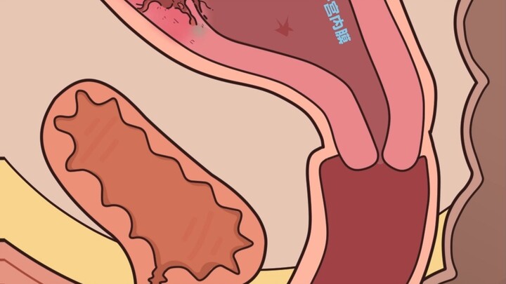 Remember to remind Mom to take it off!