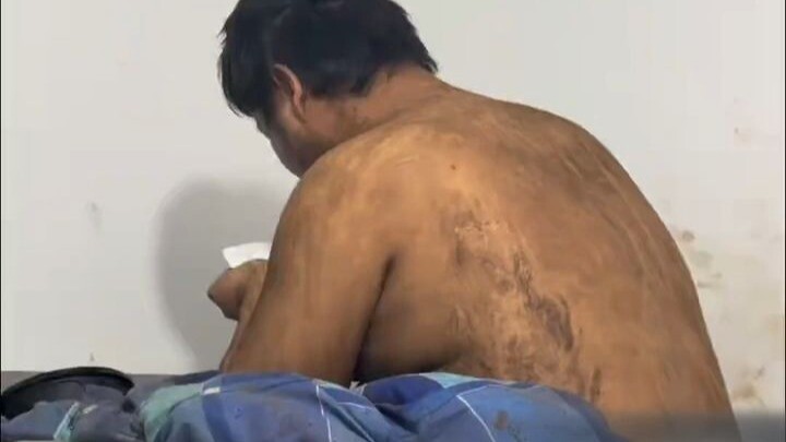 Kakak Jamur Parasit Jamur