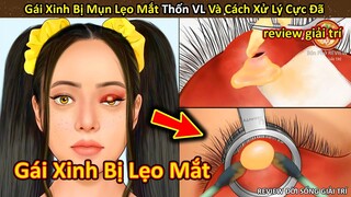 Nhím Cute Review Gái Xinh bị mụt lẹo mắt khóc nức nở và cái kết || Review Giải Trí Đời Sống