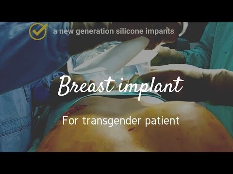 A new generation silicone breast Implant in Transgender patient■Dr Manoj Bachhav