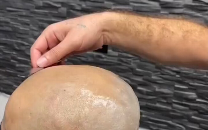 Foreigners wax their bald heads, and the style is getting outrageous