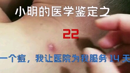 【การตรวจสอบทางการแพทย์】การตรวจสอบวิดีโอทางการแพทย์ยอดนิยมบนอินเทอร์เน็ต 22