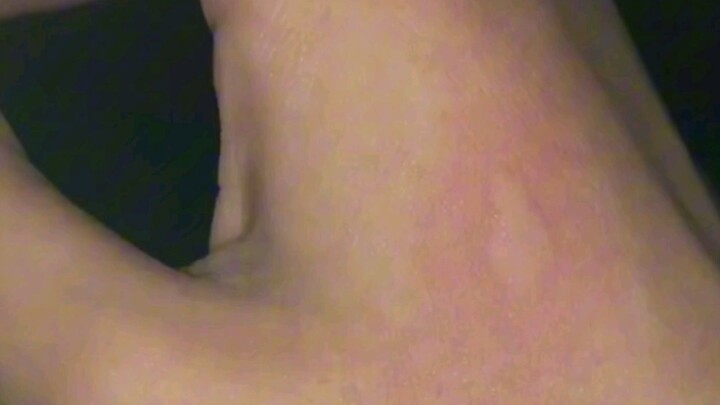 What’s the strangest physical condition you’ve ever seen?