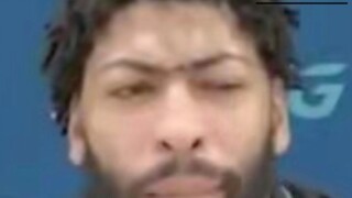 "Esports Champion - Anthony Davis"