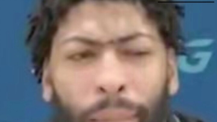 "Juara Esports - Anthony Davis"