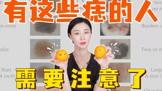 أصحاب هذه الأنواع من الشامات عليهم توخي الحذر!