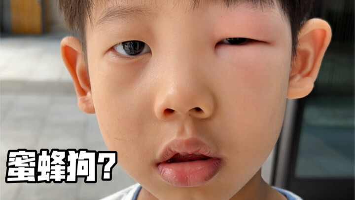 The second brother, stung all over like a bee-dog, didn't miss a beat while showing off his meal.