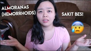 PAANO MAWALA ANG ALMORANAS (HEMORRHOIDS)