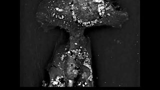 Label-free Live Cell Imaging: Glioblastoma cells undergoing autophagy