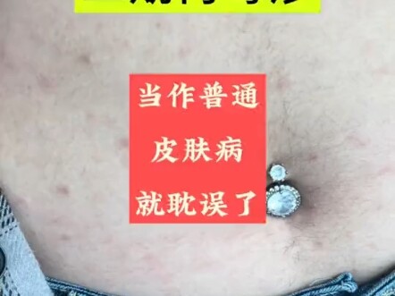 العبث منذ سن السادسة عشرة